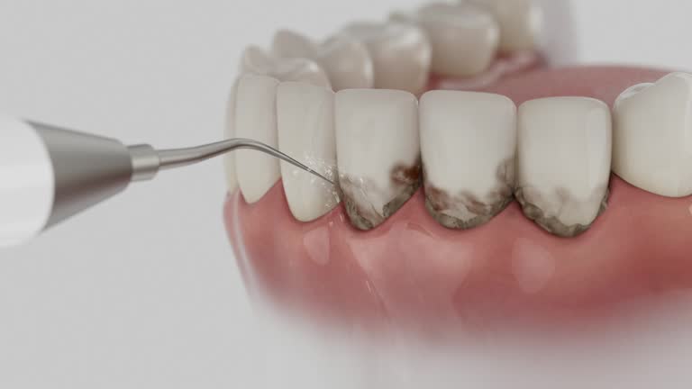 Reliable Dental Implants contractor in Meraux, LA by Smile Center Dentistry